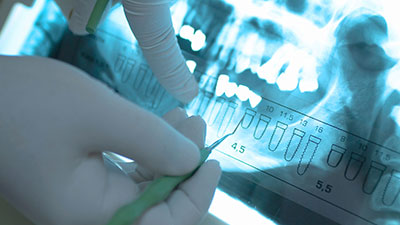 Dental Assistant